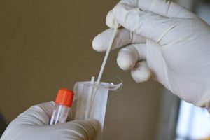 PCR test payments to close
